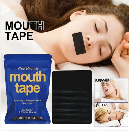 SilentNight Mouth Strips